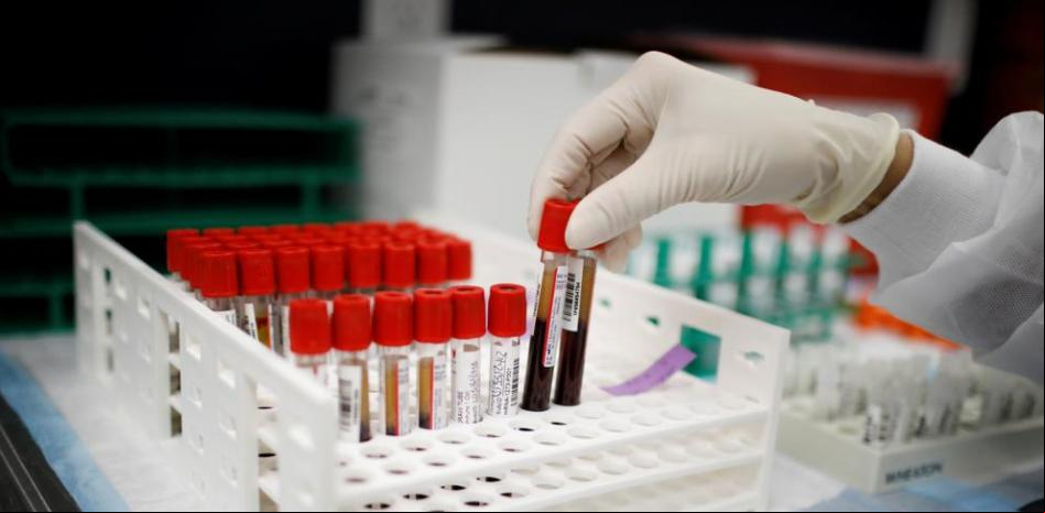 Las transfusiones de plasma resultan ineficaces contra la covid grave
