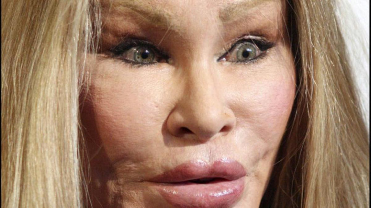 Muere Jocelyne Wildenstein, conocida como “Catwoman”, por una embolia pulmonar