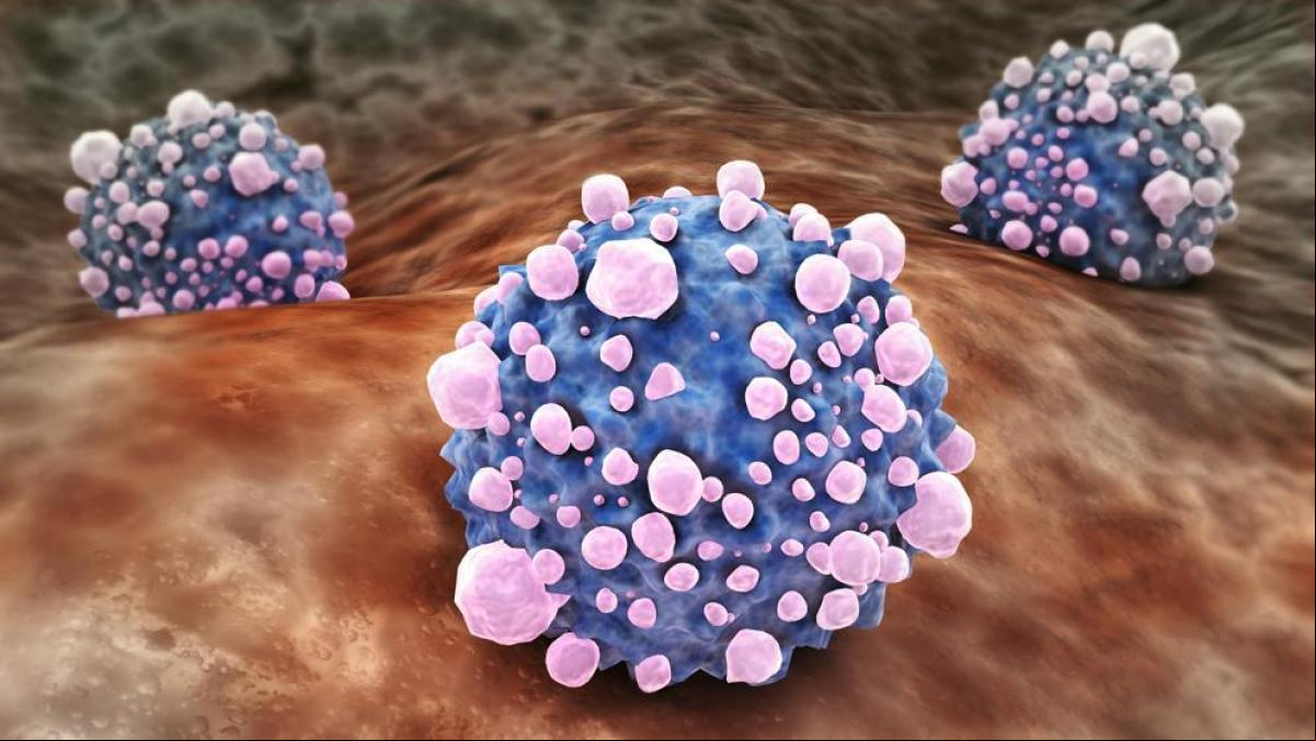 ¿Una gota de sangre seca servirá para detectar a tiempo el cáncer de páncreas?