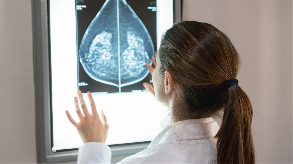 Barcelona lidera un proyecto para el diagnóstico del cáncer de mama con una técnica sin radiación