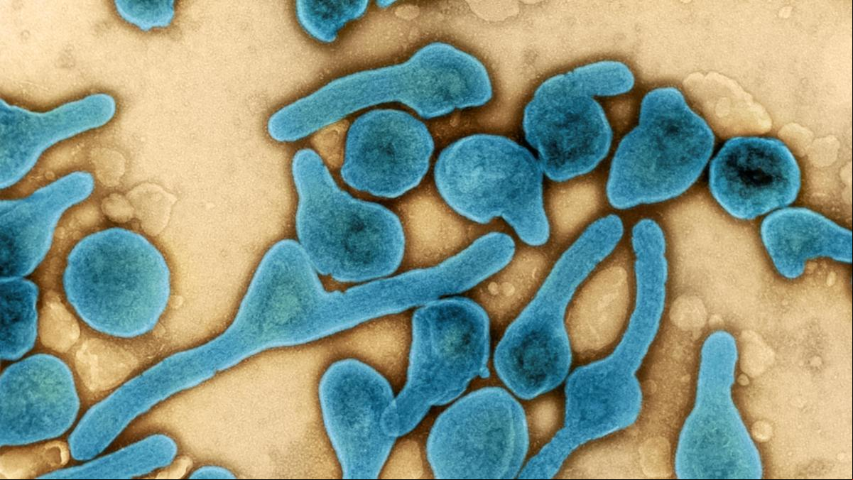 Reaparece el virus de Marburgo, primo hermano del ébola, y causa el mayor brote desde 2005