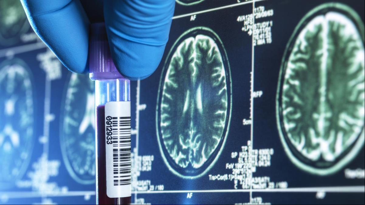 Hallada una proteína que frena el envejecimiento del cerebro