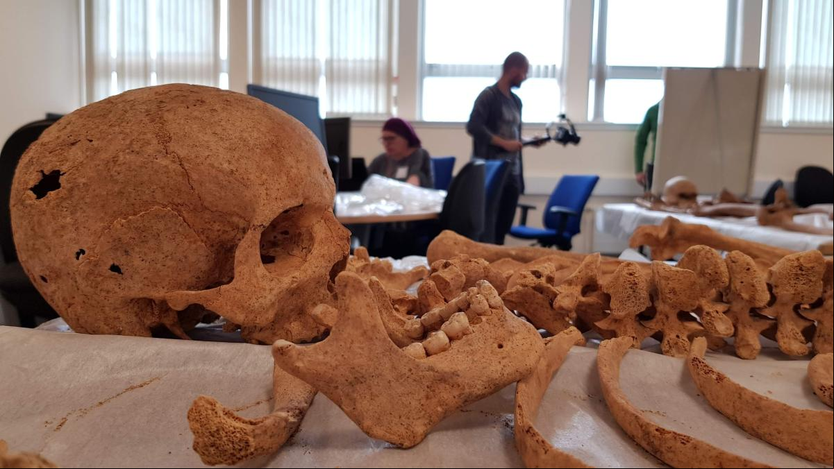 La Universidad de Aberdeen devolverá la calavera de un aborigen australiano asesinado que conserva desde hace 200 años La Universidad de Aberdeen devolverá la calavera de un aborigen australiano asesinado que conserva desde hace 200 años