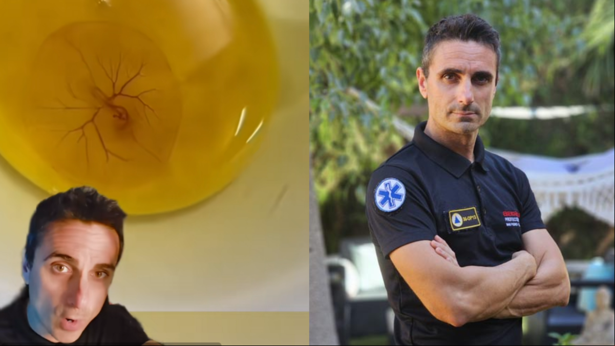 Miguel Assal, experto en emergencias, explica cómo identificar un huevo fertilizado: “Si al abrirlo ves esto, está en proceso de formar un pollito”