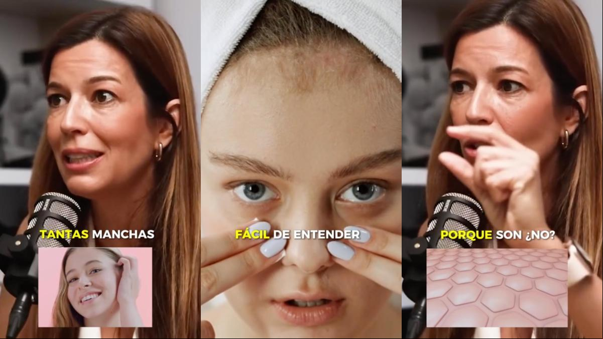 Ana Molina, dermatóloga: “Los retinoides son como los entrenadores personales de la piel porque la ponen a trabajar, son exfoliantes y generan un pelado controlado de tu piel”