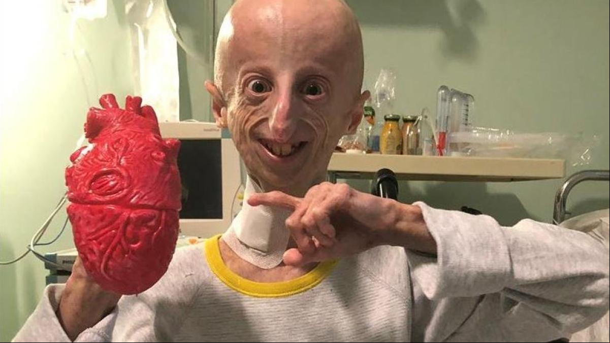 Hacen realidad el bonito deseo póstumo de Sammy Basso, la persona con progeria más longeva del mundo