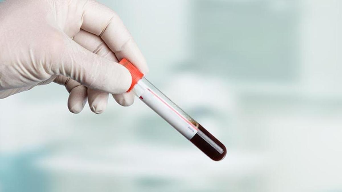 Talasemia, síntomas y causas que son importantes