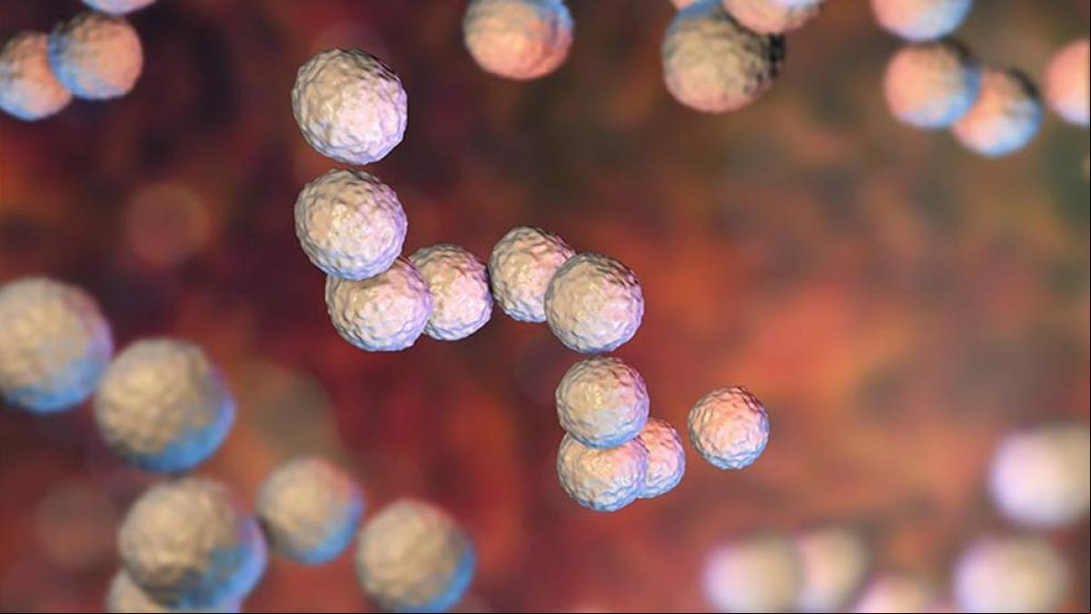 Fascitis necrosante: síntomas, causas y cómo tratar esta infección peligrosa