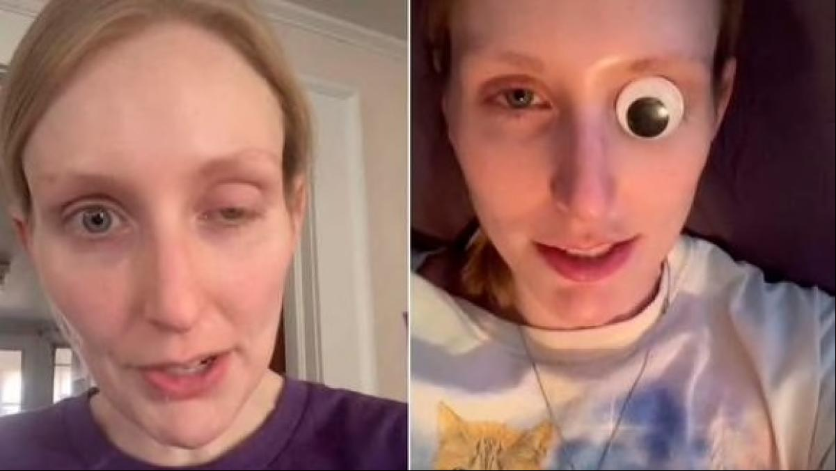 Una ‘tiktoker’ advierte de los peligros del bótox tras quedarse ciega de un ojo