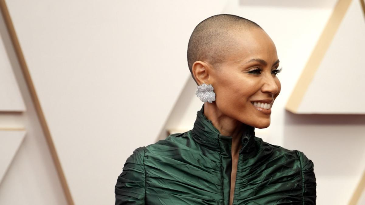 Qué es la alopecia femenina, la afección que padece Jada Pinkett Smith
