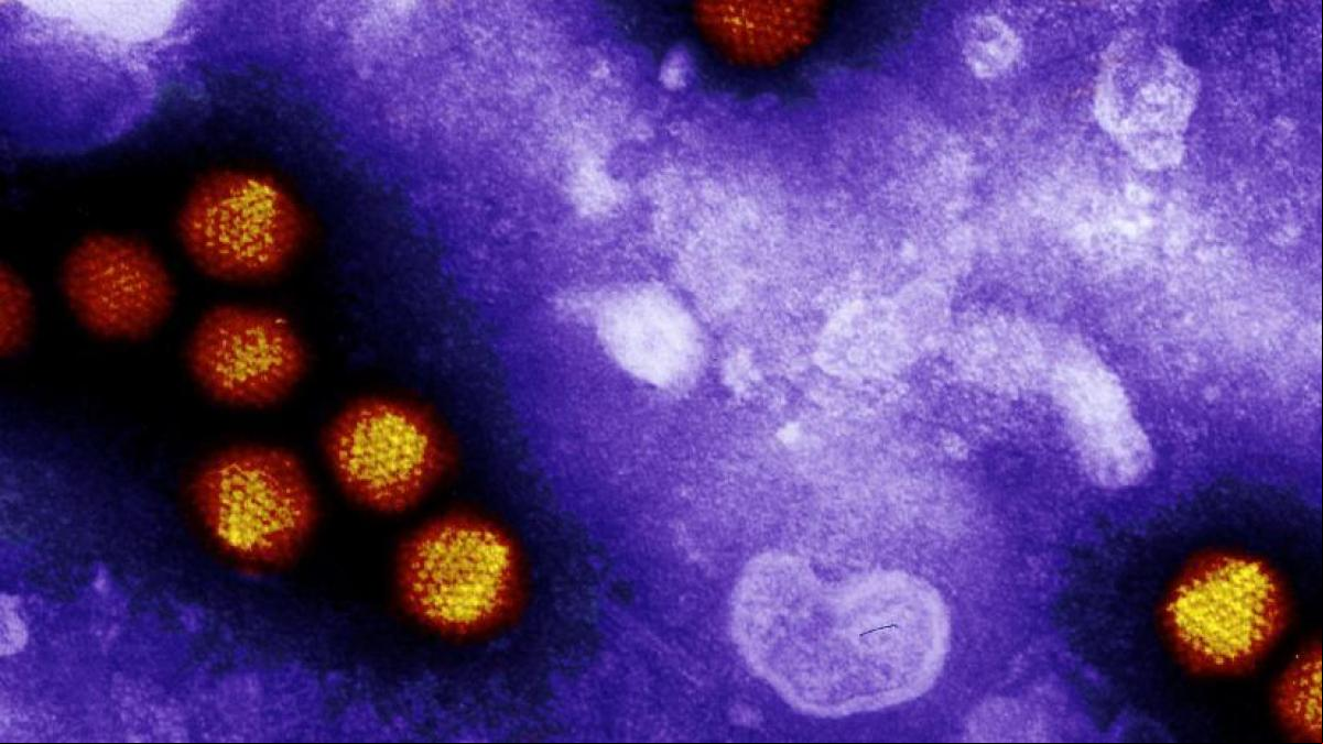 Los pediatras llaman a la cautela ante el aumento de casos de hepatitis agudas en niños