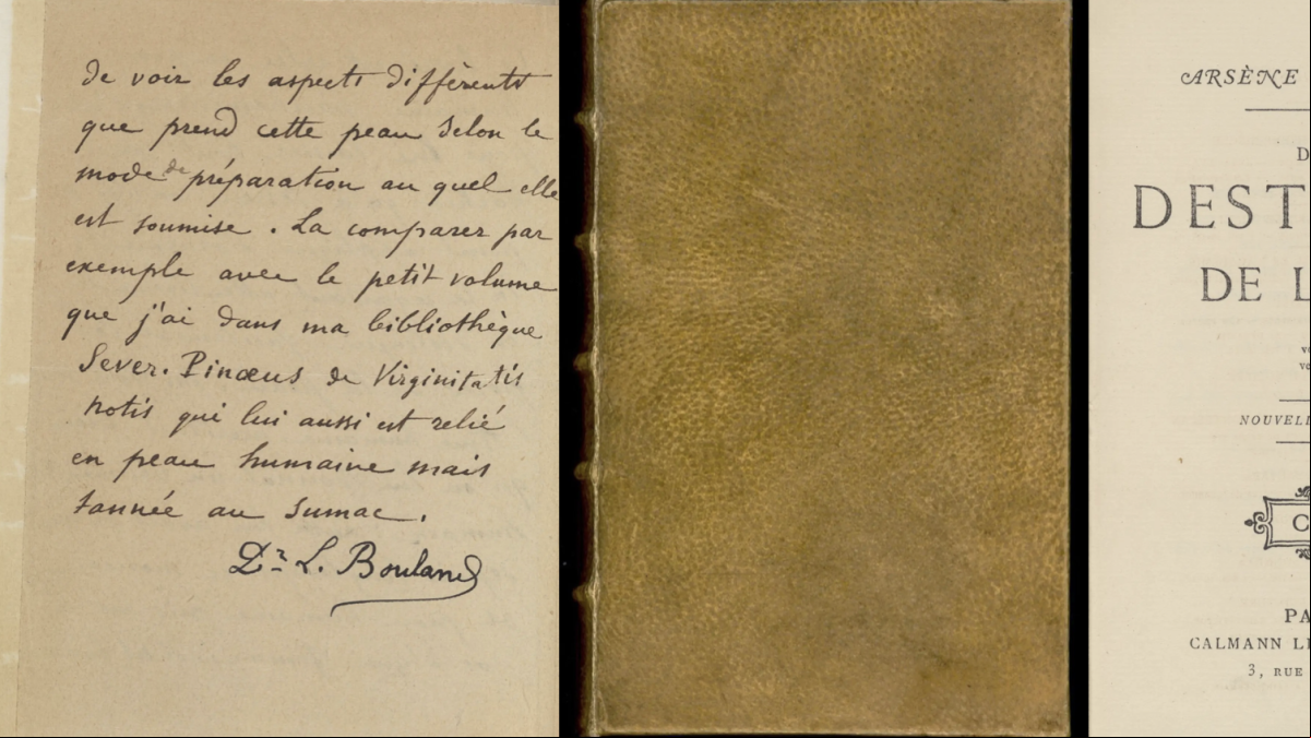 La Universidad de Harvard retira un libro de su biblioteca al descubrir que estaba hecho de piel humana