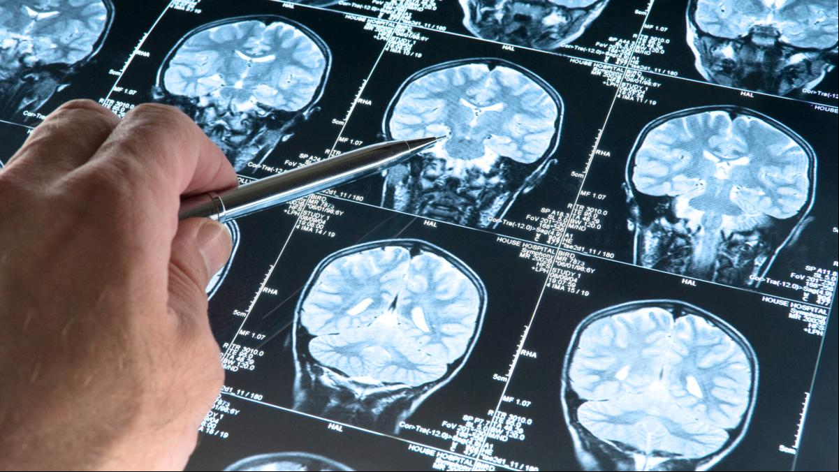 Durante el embarazo, las mujeres experimentan cambios en el 94% de la materia gris del cerebro