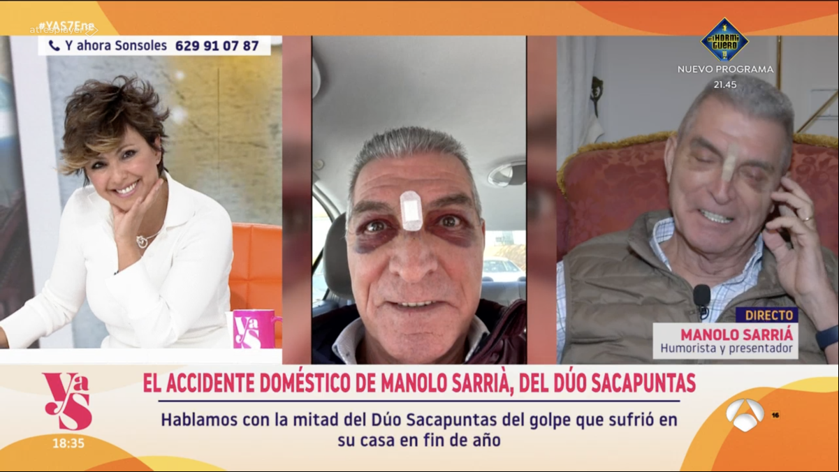 Preocupación por el cómico Manolo Sarrià tras sufrir un accidente doméstico: “Me pusieron cinco puntos de sutura”