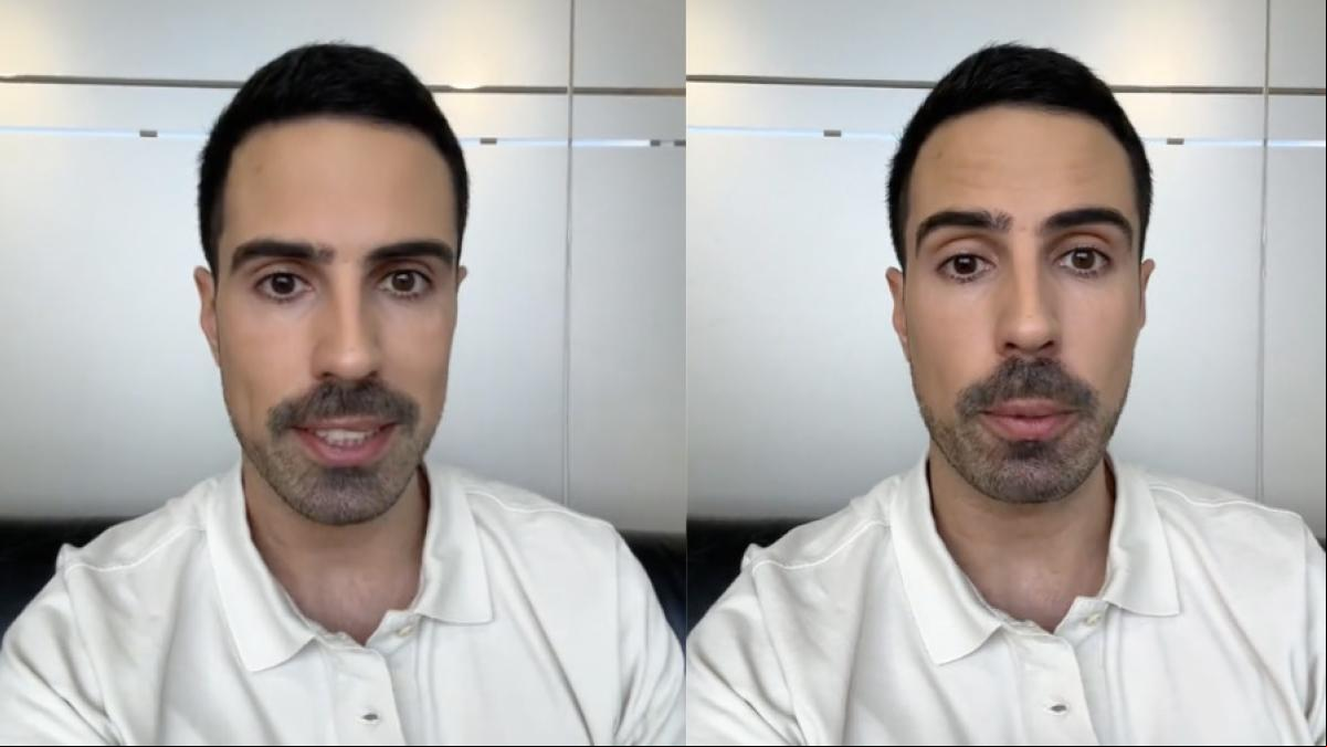 El dermatólogo español Álex Docampo, sobre si es necesario utilizar cremas hidratantes para el cuerpo: “La verdad es que no lo va a evitar a largo plazo”