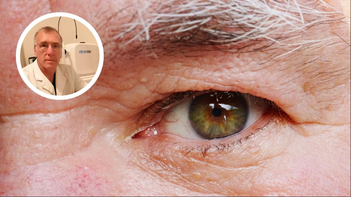 Alejo Peyret, oftalmólogo: “La gran mayoría de pacientes con glaucoma no tiene ningún síntoma, se lo llama ladrón silencioso de la visión, te quita la vista y no te enteras”