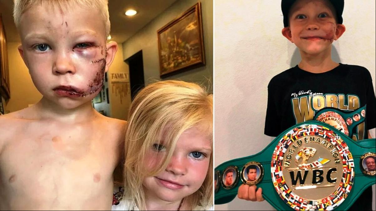 Un campeón mundial de boxeo de 6 años