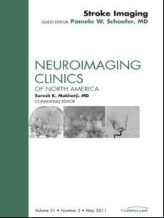 Imaging Of Ischemic Stroke An Issue Of Neuroimaging Clinics - E-book (