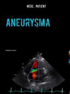 ANEURYSMA EBOOK (edición en alemán)