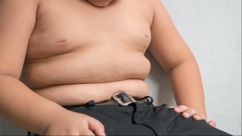 Así se puede prevenir la obesidad y la diabetes tipo 1 infantil