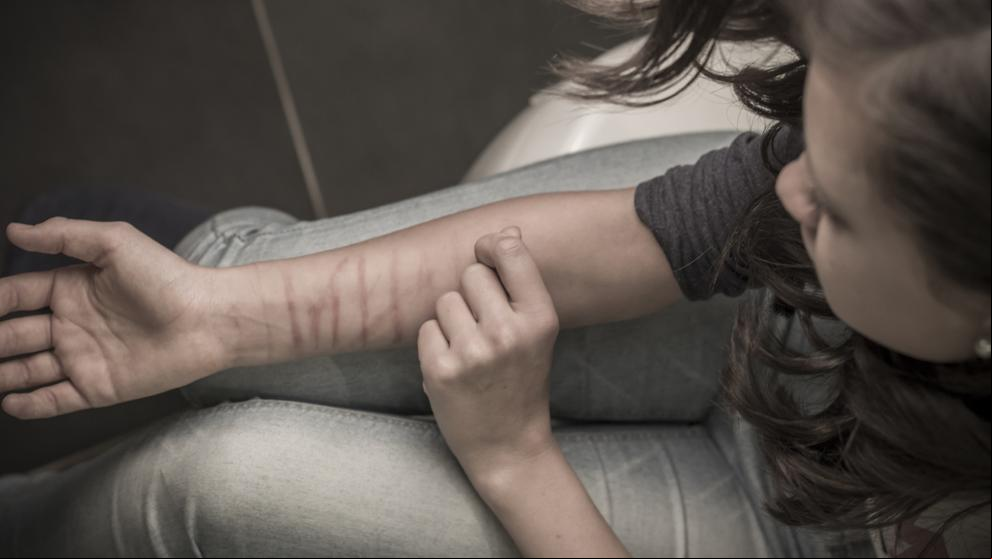 Cómo abordar la peligrosa moda de las autolesiones en adolescentes