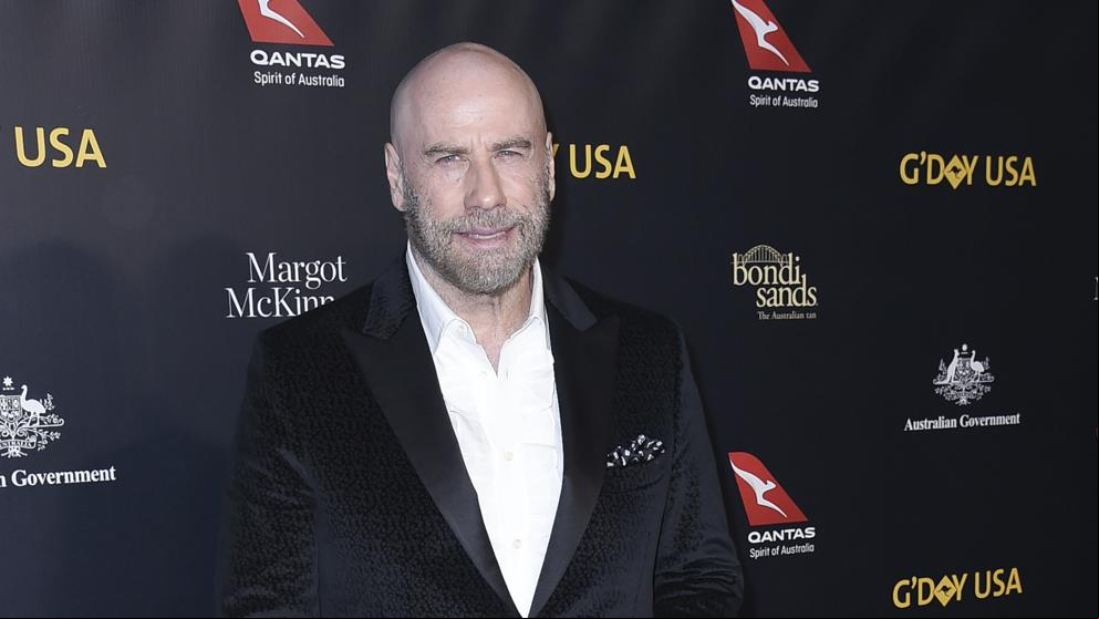 Travolta asume al fin que es calvo