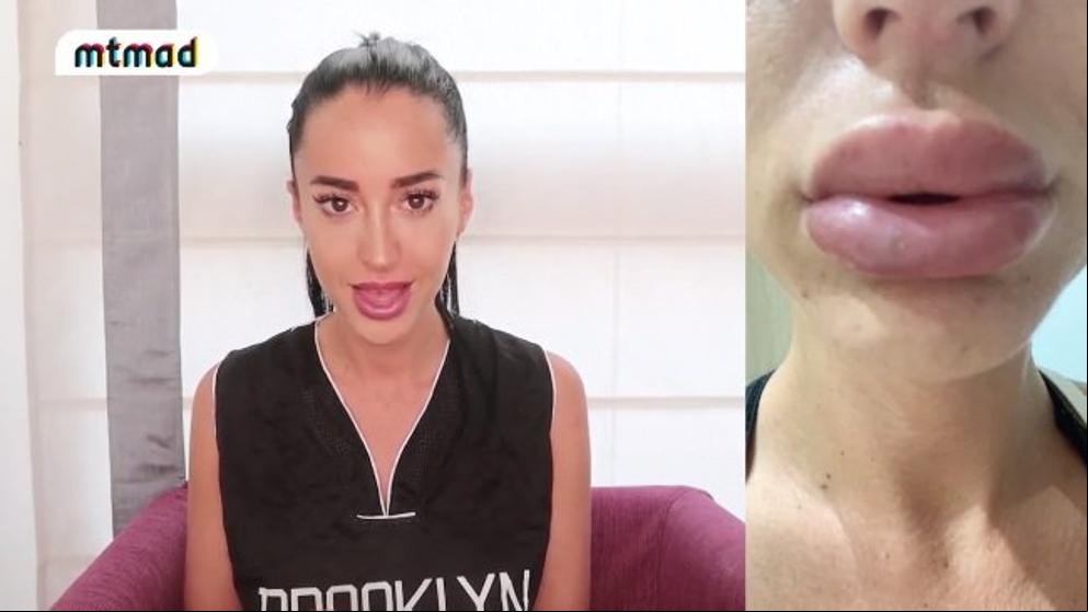 Aurah Ruiz: “Me acabo de destrozar la cara”