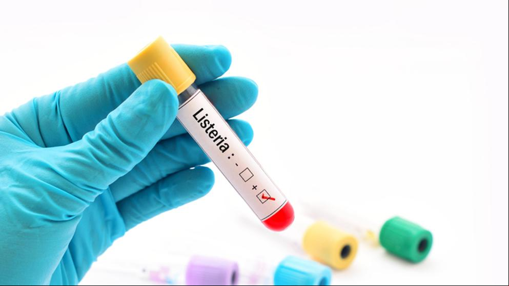 Facua pide una fianza de 1,5 millones para los investigados por el brote de listeriosis