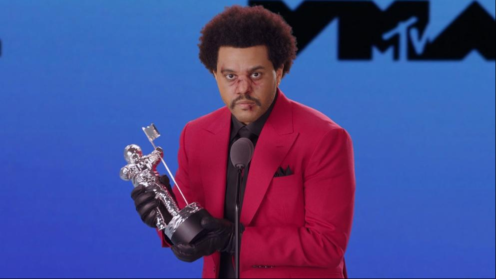 MTV VMAs: ¿Qué le ha pasado al rostro de The Weeknd?