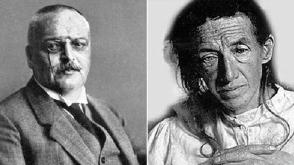 En los orígenes del Alzheimer